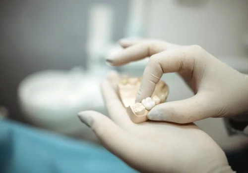 Zahntechnikerin oder Zahnarzt setzt eine künstliche Zahnkrone auf ein Zahnmodell im Labor oder Behandlungsraum.